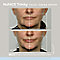 Nuface Trinity Facial Toning Device White #3