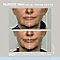 Nuface Mini Facial Toning Device  #4