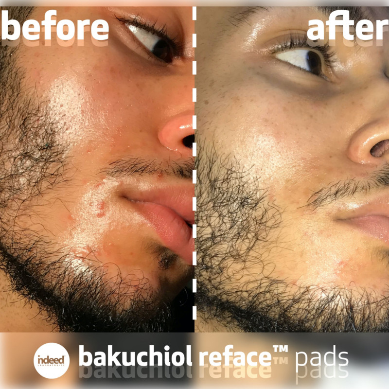 Buy Labs Retinol Reface | UP TO OFF