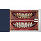 Spotlight Oral Care Dental Teeth Whitening Strips  #3