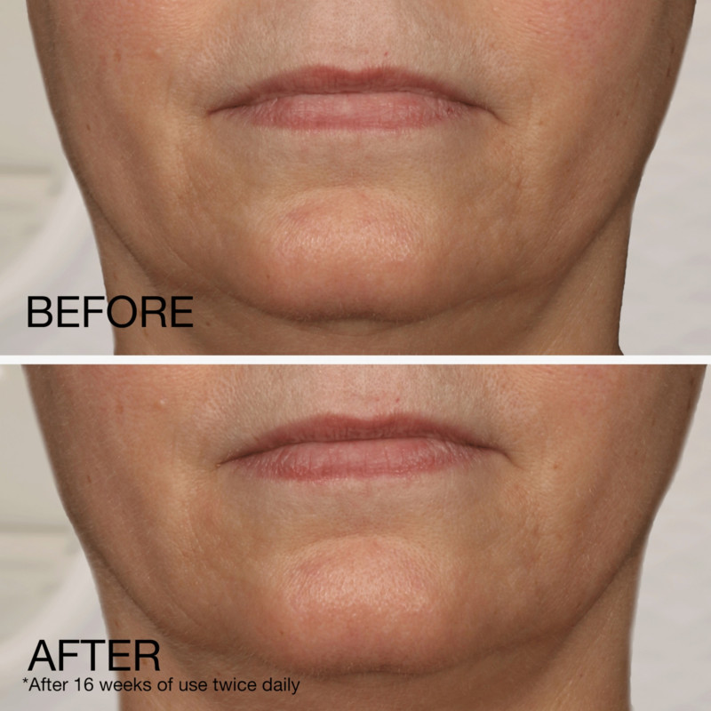 Neutrogena peptide cream deals before and after